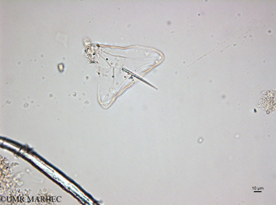 phyto/Brazilian_Amazon_coast/Amazomix_station_22/AMAZOMIX September 2021/Ditylum sol (St22_120922_ditylum220912_001_ovl).TIF(copy)_thumb.jpg